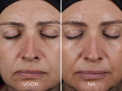 _105_DAILY_PREVENTION_Advanced_Smartblend_Mineral_Moisturizer_SPF_50_Before_After_5