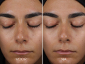 c0e65535cc6_DPEU_101_DAILY_PREVENTION_Sheer_Matte_Moisturizer_SPF_30_Before_After_5
